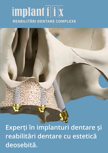 Reabilitari complexe cu implanturi dentare